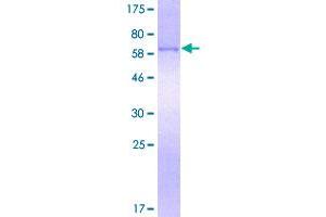 Image no. 1 for Surfactant Protein D (SFTPD) (AA 21-375) protein (GST tag) (ABIN1319782)