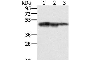 Western Blot analysis of Hepg2, K562 and Jurkat cell using SMARCB1 Polyclonal Antibody at dilution of 1:400 (SMARCB1 anticorps)