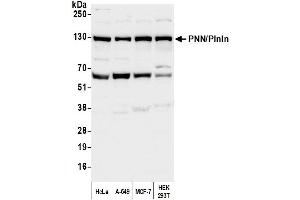 Western Blotting (WB) image for anti-Pinin, Desmosome Associated Protein (PNN) (C-Term) antibody (ABIN7451967) (PNN anticorps  (C-Term))