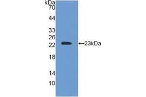 Western blot analysis of recombinant Mouse SOD2. (SOD2 anticorps  (AA 25-222))