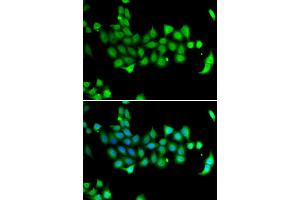 Immunofluorescence analysis of A549 cell using HSPA14 antibody. (HSPA14 anticorps)
