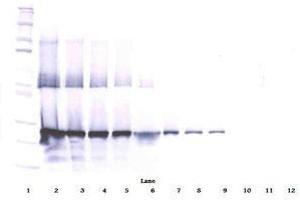Image no. 3 for anti-WNT1 Inducible Signaling Pathway Protein 2 (WISP2) antibody (ABIN465385) (WISP2 anticorps)