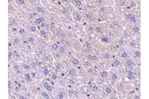 Immunohistochemistry of F1Aα in mouse liver tissue with F1Aalpha antibody at 5 μg/ml. (FEM1B anticorps  (C-Term))