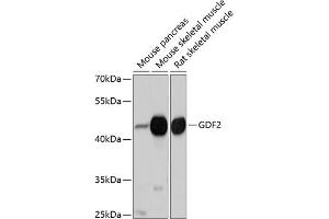 Western blot analysis of extracts of various cell lines, using GDF2 antibody (ABIN6127500, ABIN6141041, ABIN6141042 and ABIN6214818) at 1:1000 dilution. (GDF2 anticorps  (AA 320-429))