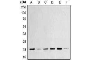 Western blot analysis of BAX expression in MCF7 (A), HeLa (B), A431 (C), HEK293T (D), Raw264. (BAX anticorps  (N-Term))