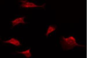 ABIN6274598 staining Hela by IF/ICC. (LI Cadherin anticorps  (Internal Region))