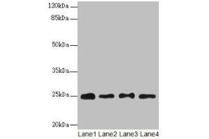 Western blot All lanes: RPS8 antibody at 6 μg/mL Lane 1: HL60 whole cell lysate Lane 2: THP-1 whole cell lysate Lane 3: 293T whole cell lysate Lane 4: Mouse liver tissue Secondary Goat polyclonal to rabbit IgG at 1/10000 dilution Predicted band size: 25 kDa Observed band size: 25 kDa (RPS8 anticorps  (AA 2-208))