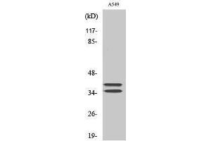 Western Blotting (WB) image for anti-Linker For Activation of T Cells (LAT) (Tyr660) antibody (ABIN3175823) (LAT anticorps  (Tyr660))