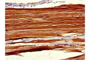 Immunohistochemistry of paraffin-embedded human skeletal muscle tissue using ABIN7158320 at dilution of 1:100 (LHFPL5 anticorps  (AA 46-99))
