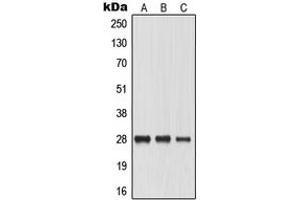 Western blot analysis of Aquaporin 0 expression in HeLa (A), SP2/0 (B), PC12 (C) whole cell lysates. (MIP anticorps  (Center))