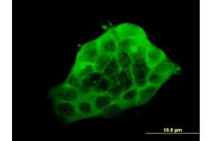 Immunofluorescence of monoclonal antibody to LDB3 on A-431 cell.