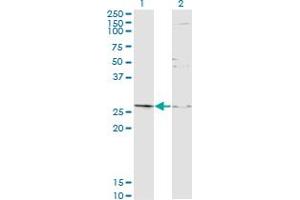 Western Blot analysis of TGIF2 expression in transfected 293T cell line by TGIF2 monoclonal antibody (M16A), clone 2D4. (TGIF2 anticorps  (AA 1-237))