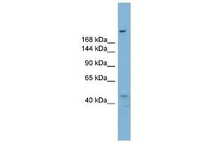 RBBP6 antibody used at 1 ug/ml to detect target protein. (RBBP6 anticorps  (N-Term))