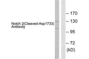 Western blot analysis of extracts from 293 cells treated with TNF-a (20ng/ml, 30mins), using Notch 2 (cleaved-Asp1733) antibody. (NOTCH2 anticorps  (Cleaved-Asp1733))