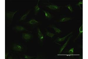 Immunofluorescence of purified MaxPab antibody to FTL on HeLa cell. (FTL anticorps  (AA 1-175))