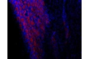 Expression of TRPC3 in rat DRG - Immunohistochemical staining of rat dorsal root ganglion (DRG) frozen sections using Anti-TRPC3-ATTO Fluor-594 Antibody (ABIN7043819), (1:50).