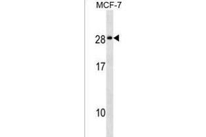 NKAI4 Antibody (C-term) (ABIN1536774 and ABIN2849663) western blot analysis in MCF-7 cell line lysates (35 μg/lane). (NKAIN4 anticorps  (C-Term))