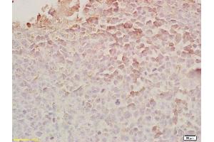 Formalin-fixed and paraffin embedded rat brain tissue labeled Anti-Chemerin/TIG2 Polyclonal Antibody, Unconjugated (ABIN687427) at 1:200, followed by conjugation to the secondary antibody and DAB staining (Chemerin anticorps  (AA 81-163))