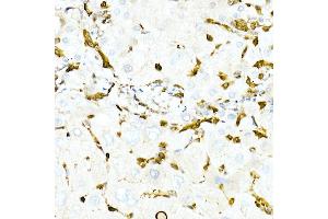 Immunohistochemistry of paraffin-embedded Human liver using GST3/GSTP1 antibody (ABIN7267448) at dilution of 1:100 (40x lens). (GSTP1 anticorps)