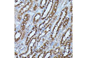 Immunohistochemistry of paraffin-embedded mouse kidney using FGD1 antibody (ABIN7267284) at dilution of 1:100 (40x lens). (FGD1 anticorps  (AA 700-800))