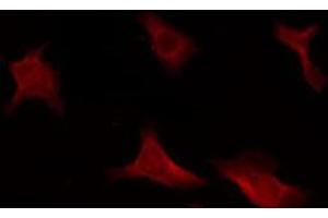 ABIN6266609 staining HeLa by IF/ICC. (CDKN2B anticorps  (Internal Region))