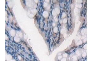 Detection of GR in Mouse Colon Tissue using Polyclonal Antibody to Glutathione Reductase (GR)