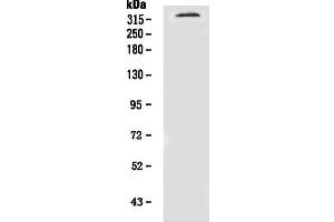 Western blot analysis of NF1 using anti-NF1 antibody (ABIN7600195).