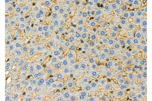 ABIN6257071 and ABIN6274969 at 1/100 staining Rat liver tissue by IHC-P. (CPE anticorps  (Internal Region))