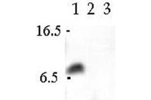 Western Blot analsyis using Cellubrevin antibody in Human CaCo-2 cell extract (Lane 1), Canine MDCK cell extract (Lane 2) and Rat PC12 cell extract. (VAMP3 anticorps  (N-Term))