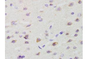 Formalin-fixed and paraffin embedded rat brain labeled with Anti-GALR2 Polyclonal Antibody, Unconjugated (ABIN1386167) at 1:200 followed by conjugation to the secondary antibody and DAB staining