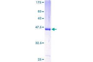 Image no. 1 for Hippocalcin Like 4 (HPCAL4) (AA 1-191) protein (GST tag) (ABIN1307025)