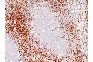 Formalin-fixed, paraffin-embedded human Tonsil stained with CD6 Monoclonal Antibody (C6/372+3F7B5). (CD6 anticorps)