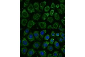 Immunofluorescence analysis of L929 cells using MK1 Polyclonal Antibody (ABIN7268647) at dilution of 1:100 (40x lens).