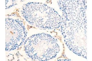 ABIN6267284 at 1/100 staining mouse testicular tissue sections by IHC-P.