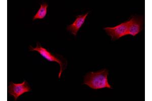 ABIN6257584 and ABIN6274265 staining Hela by IF/ICC. (CK1 epsilon anticorps  (Internal Region))