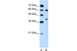 WB Suggested Anti-ARG1 Antibody Titration:  5.