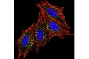 Image no. 5 for anti-CD63 (CD63) antibody (ABIN6188015)