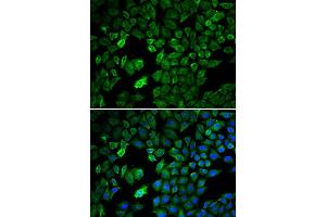 Immunofluorescence analysis of U2OS cell using PRMT5 antibody. (PRMT5 anticorps)