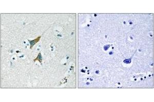 Immunohistochemistry (IHC) image for anti-Dual Specificity Phosphatase 1 (DUSP1) (AA 318-367) antibody (ABIN2888897) (DUSP1 anticorps  (AA 318-367))