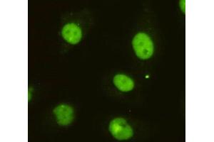Immunocytochemistry of HeLa cells using anti-DBC1 mouse mAb diluted 1:200.