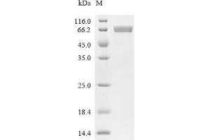(Tris-Glycine gel) Discontinuous SDS-PAGE (reduced) with 5 % enrichment gel and 15 % separation gel.