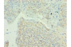 Immunohistochemistry of paraffin-embedded human tonsil tissue using ABIN7160003 at dilution of 1:100 (MAPK4 anticorps  (AA 348-587))