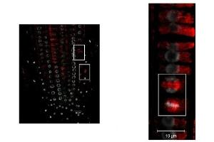 Immunohistochemistry (IHC) image for anti-Tubulin alpha Chain (TUB1) antibody (ABIN7477855) (Tubulin alpha Chain (TUB1) anticorps)