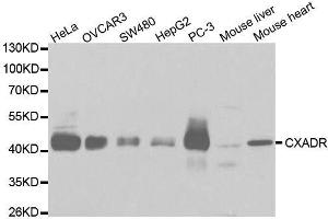 Western blot analysis of extracts of various cell lines, using CXADR antibody. (Coxsackie Adenovirus Receptor anticorps  (AA 20-237))