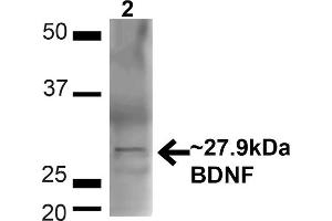 Western blot analysis of Mouse Brain showing detection of ~27. (BDNF anticorps  (N-Term) (PE))