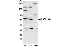 Western Blotting (WB) image for anti-LAP2 beta/tmpo (AA 300-350) antibody (ABIN7455056) (LAP2 beta/tmpo (AA 300-350) anticorps)