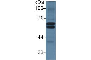 Detection of LCAT in Mouse Liver lysate using Polyclonal Antibody to Lecithin Cholesterol Acyltransferase (LCAT) (LCAT anticorps  (AA 290-432))