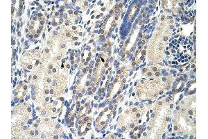 EIF4E2 antibody was used for immunohistochemistry at a concentration of 4-8 ug/ml to stain Epithelial cells of renal tubule (arrows) in Human Kidney. (EIF4E2 anticorps  (N-Term))