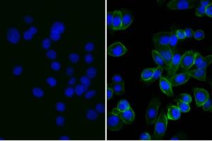 Human pancreatic carcinoma cell line MIA PaCa-2 was stained with Mouse Anti-Human CD44-UNLB and DAPI. (Lapin anti-Souris IgG (Heavy & Light Chain) Anticorps (FITC))