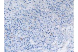 IHC-P analysis of Rat Adrenal Gland Tissue, with DAB staining. (Cholecystokinin anticorps  (AA 1-115))